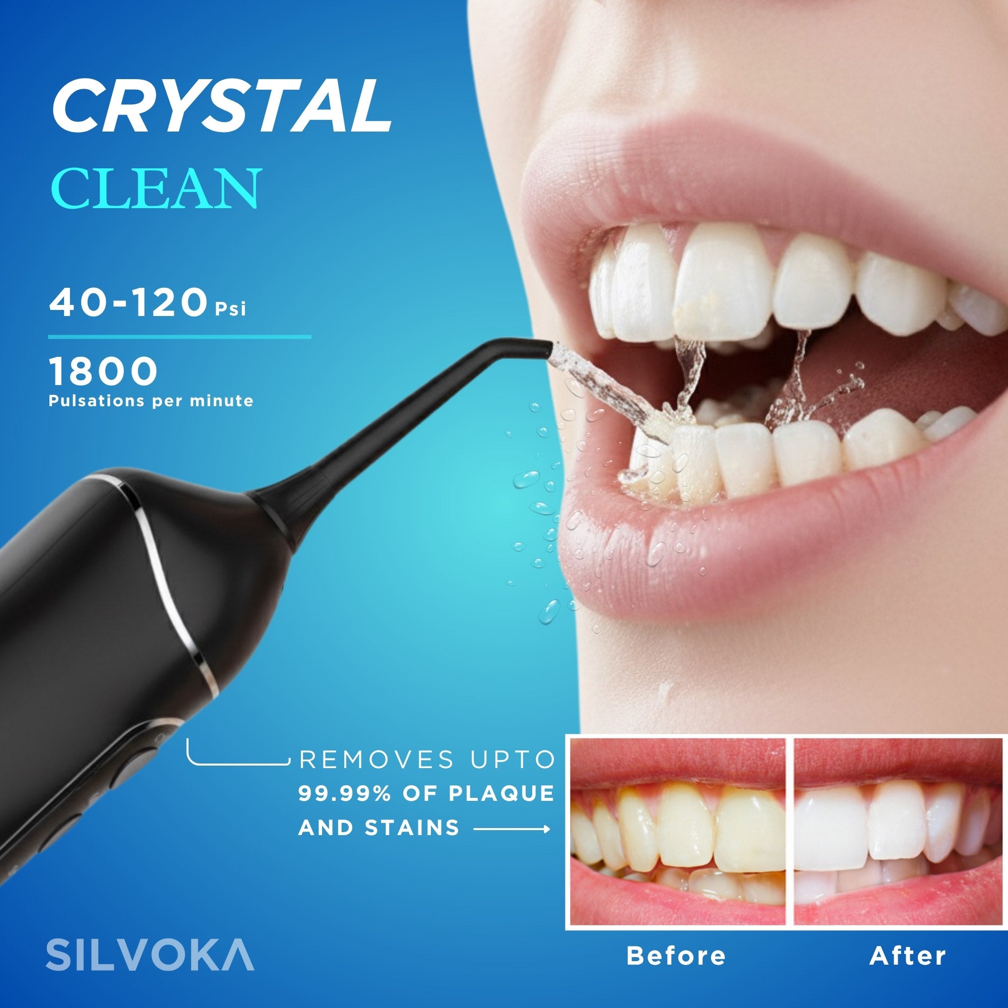SILVOKA Water Flosser for Teeth, Cordless Oral Irrigator, Portable Dental Flosser with 300ML Tank, 4 Cleaning Modes, IPX7 Waterproof, Rechargeable Water Floss Pick for Braces, Gum Care & Travel